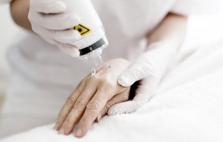 Laserterapia aplicada na mão de mulher
