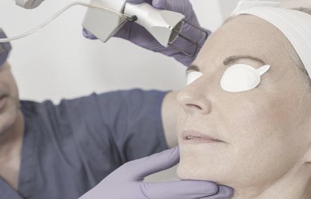 Mulher recebendo um tratamento facial a laser.