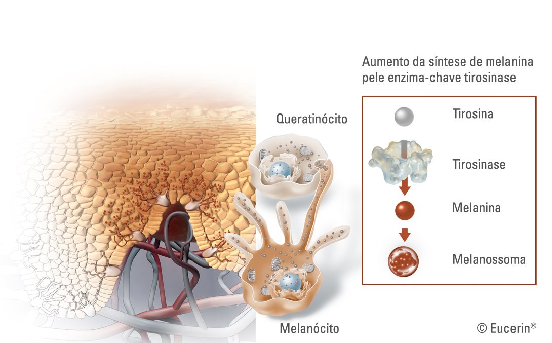 Ilustração da aparência da pigmentação da pele